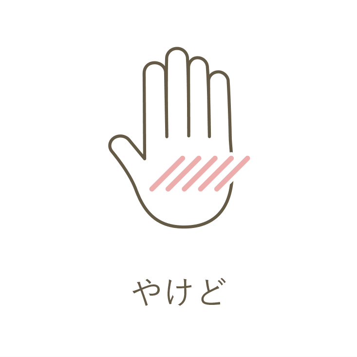 やけど