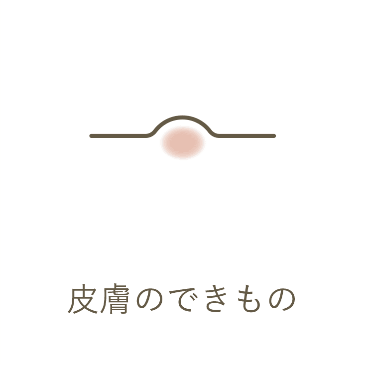 皮膚のできもの