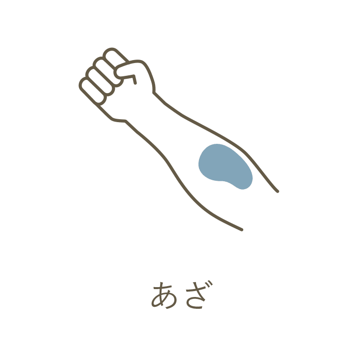 あざ